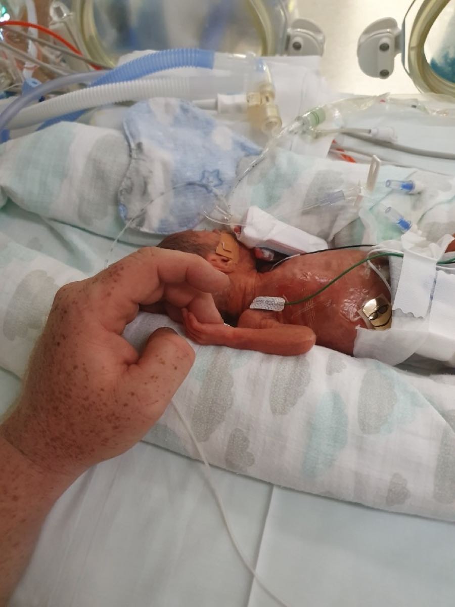 Axel and Archer in NICU after arriving at 25 weeks in September 2021
